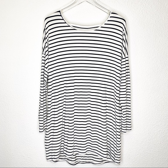 HYFVE Tops - HYFVE Oversized Striped Tunic Dress